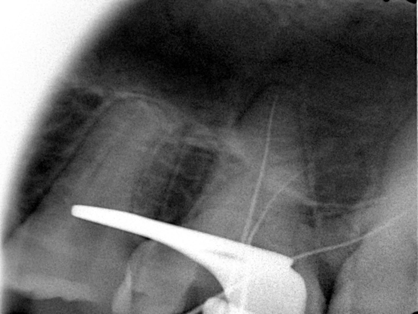 Before treatment