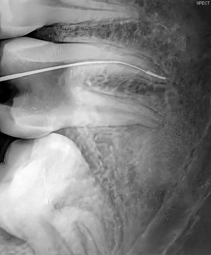 Before treatment