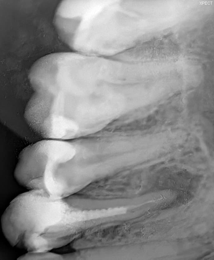 Before treatment