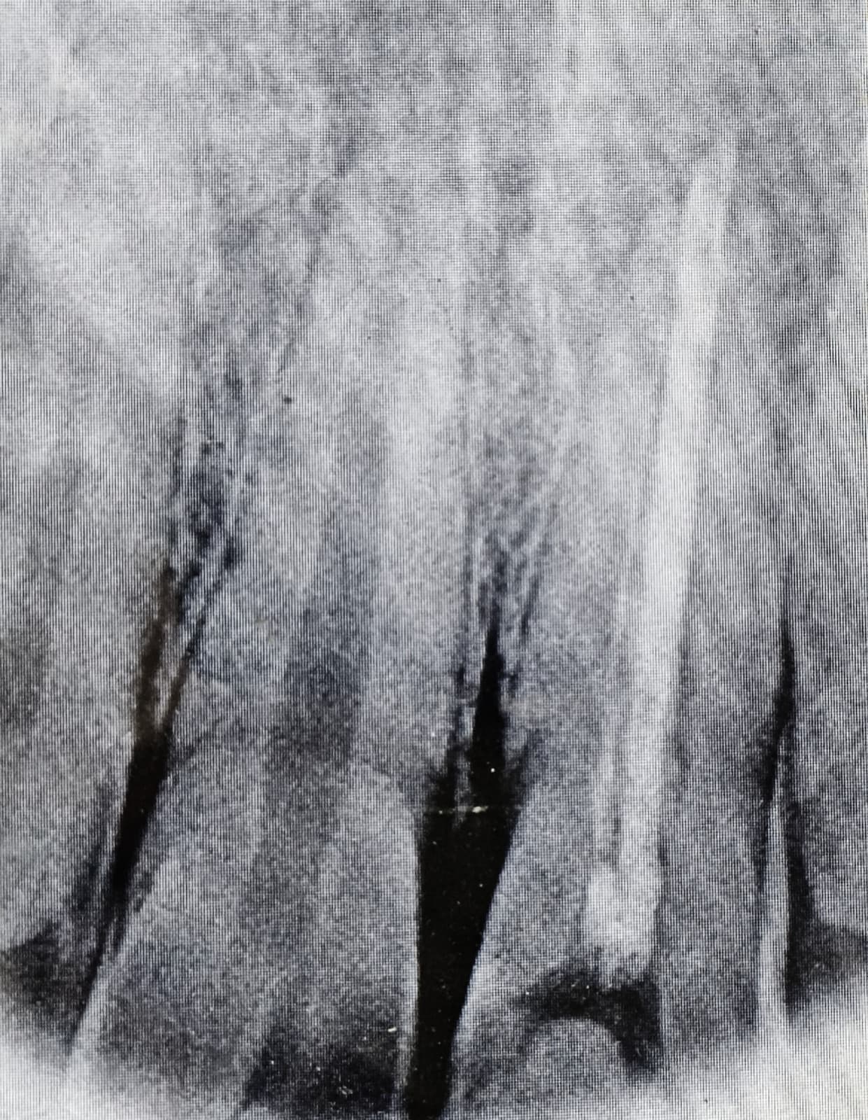 Before treatment